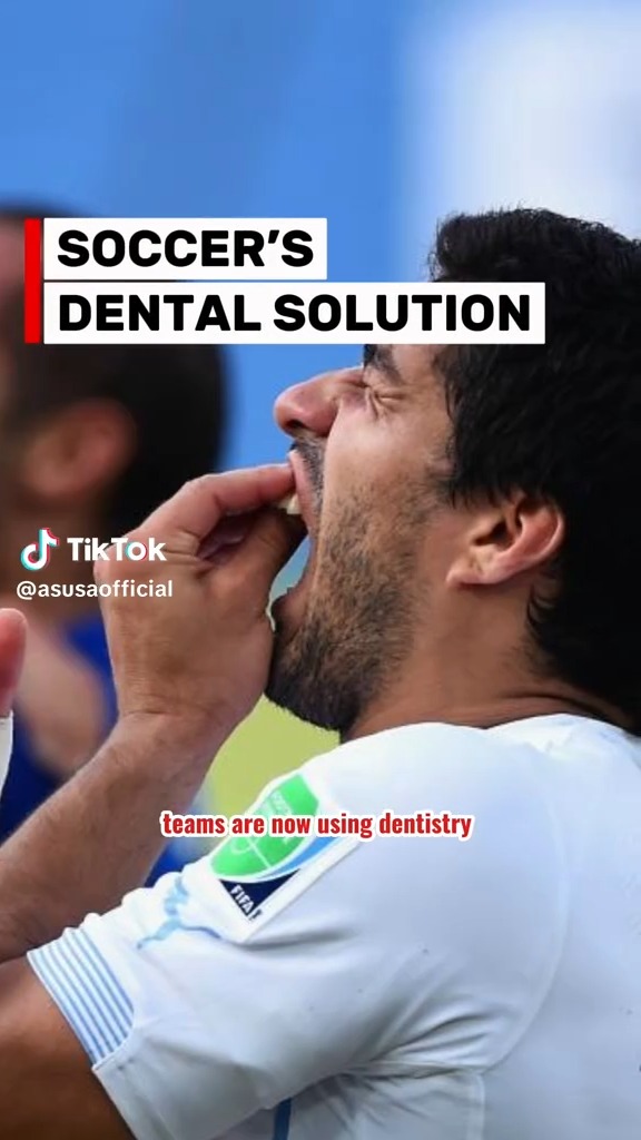 Eduardo Camavinga out with toothache