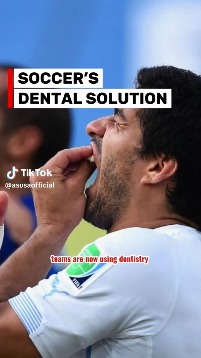 Eduardo Camavinga out with toothache